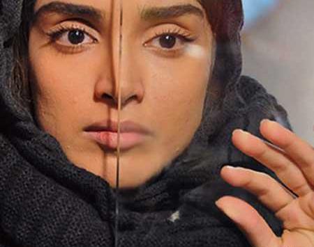 عکس الهه حصاری قبل عمل