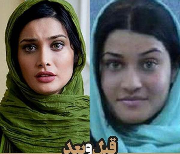 عکس الهه حصاری قبل عمل