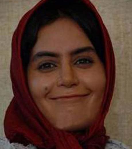 عکسهای الناز شاکردوست قبل عمل