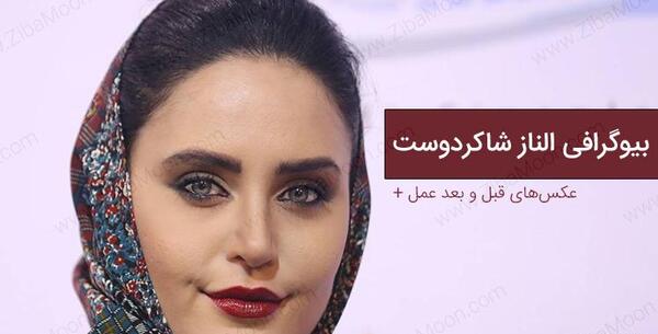 عکسهای الناز شاکردوست قبل عمل