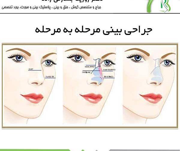 عکس در حال عمل بینی