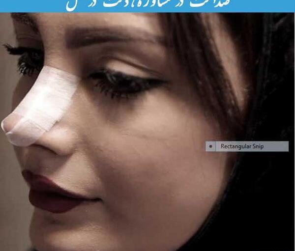 عکس در حال عمل بینی