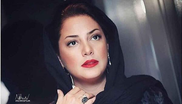 عکسهای طناز طباطبایی قبل از عمل زیبایی