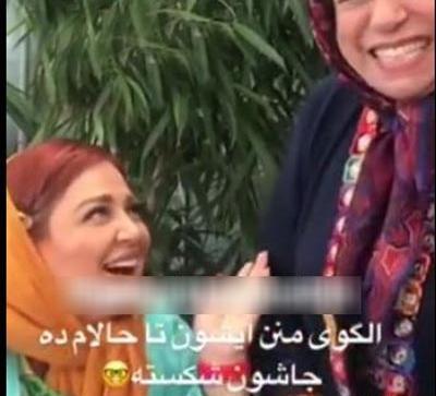 عکس بهاره رهنما با پای شکسته