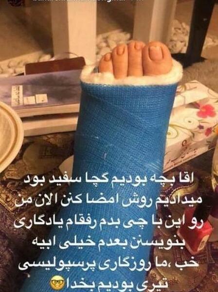 عکس بهاره رهنما با پای شکسته