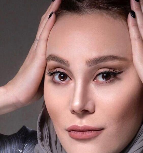 عکس لیندا کیانی قبل از عمل بینی