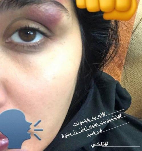 عکس پروفایل کتک زدن همسر