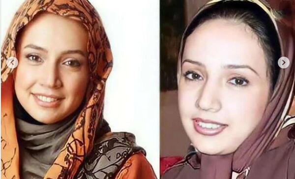 عکس شبنم قلی خانی قبل