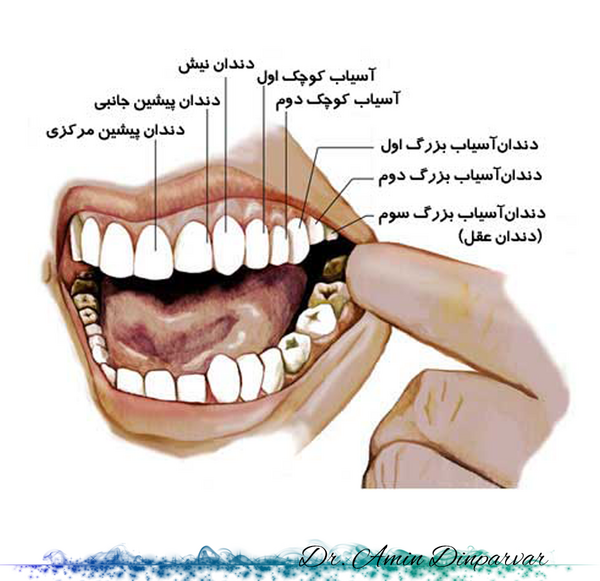 عکس تاج دندان