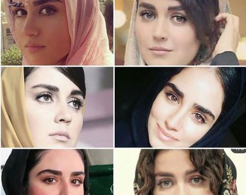 عکس افسانه پاکرو قبل عمل