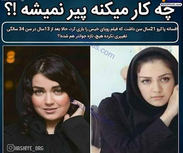 عکس افسانه پاکرو قبل عمل
