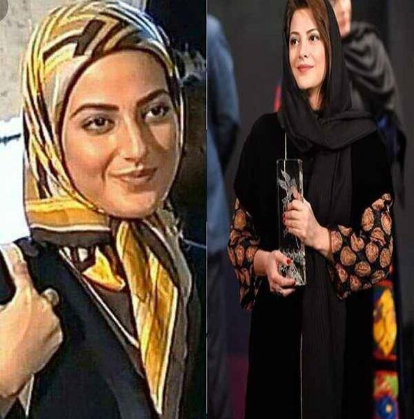 عکس بهنوش طباطبایی قبل از جراحی بینی