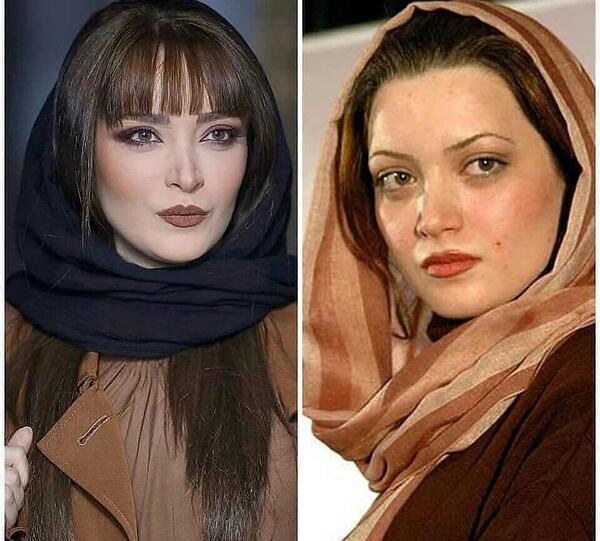 عکس بهنوش طباطبایی قبل از جراحی بینی