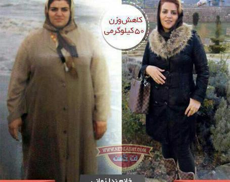 عکس کاهش وزن رابعه اسکویی