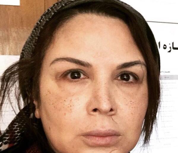 عکس لاغری شهره سلطانی