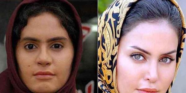 عکس شبنم قلی خانی قبل از عمل بینی