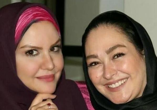عکس الهام حمیدی قبل و بعد از عمل