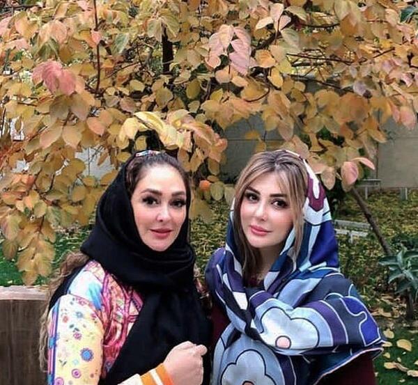 عکس الهام حمیدی قبل و بعد از عمل