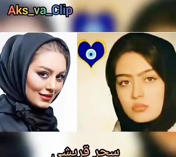 عکس الهام حمیدی قبل و بعد از عمل