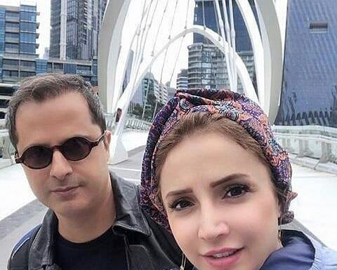 عکس شبنم قلی خانی قبل عمل بینی