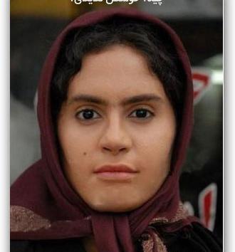 عکس الناز شاکر دوست قبل از عمل جراحی