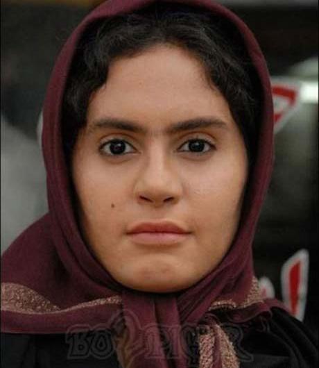 عکس الناز شاکر دوست قبل از عمل جراحی