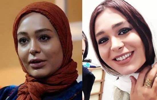 عکس سانیا سالاری قبل عمل
