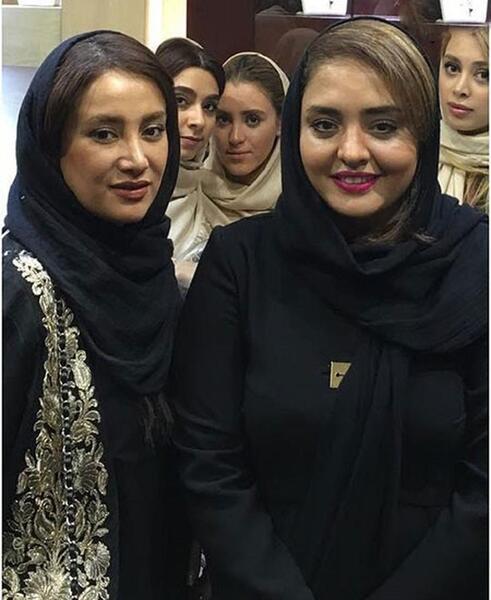 عکس بهاره افشاری قبل از عمل زیبایی
