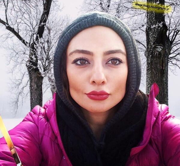 عکس بهاره افشاری قبل از عمل زیبایی