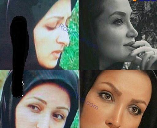 عکس بهاره افشاری قبل از عمل زیبایی