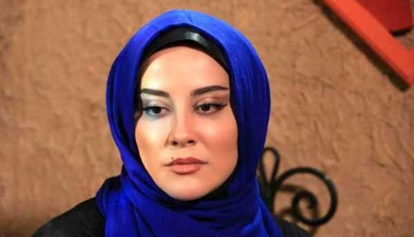عکس آشا محرابی قبل از عمل زیبایی