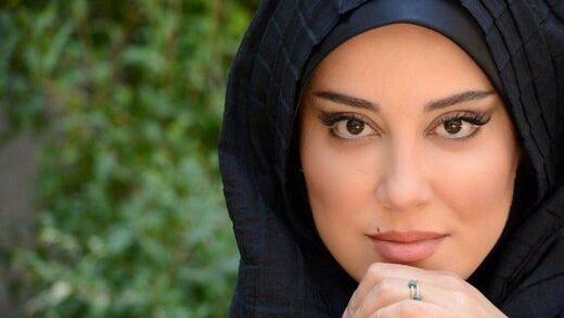 عکس آشا محرابی قبل از عمل زیبایی