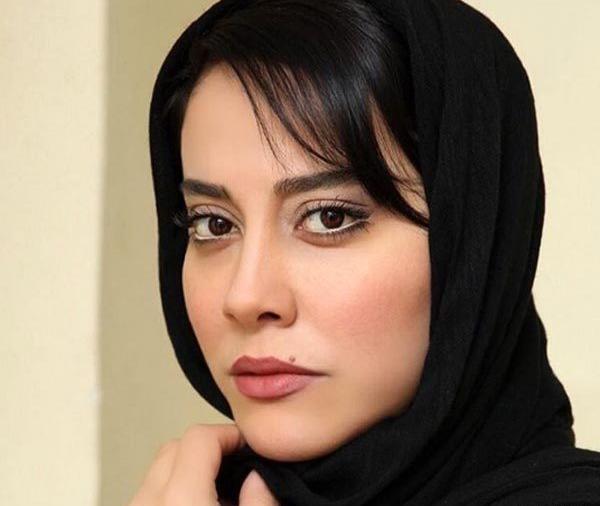 عکس آشا محرابی قبل از عمل زیبایی