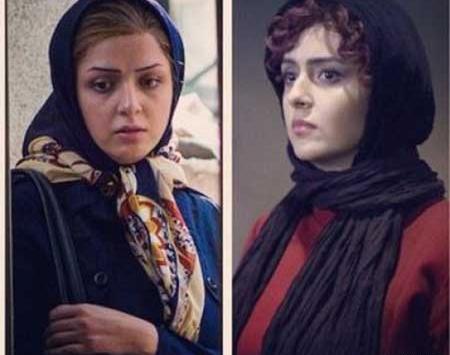 عکس ترانه علیدوستی قبل از عمل زیبایی