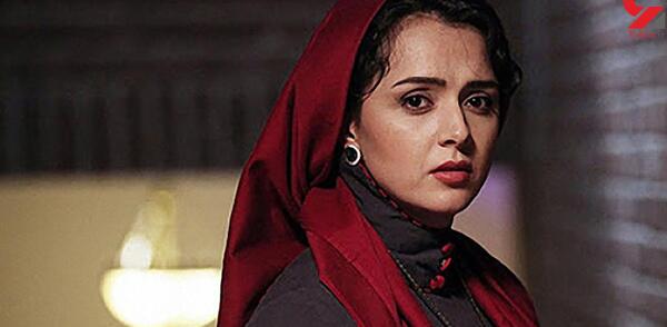 عکس ترانه علیدوستی قبل از عمل زیبایی