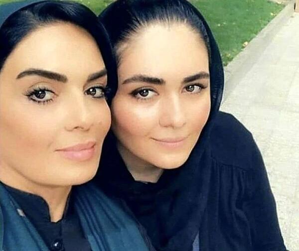 عکس سارا خوئینی ها قبل از عمل