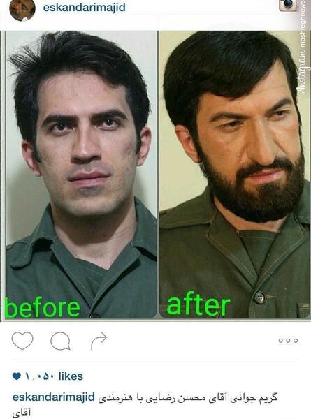 عکس قبل بعد بوتاکس محسن رضایی