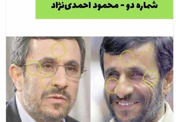 عکس قبل بعد بوتاکس محسن رضایی