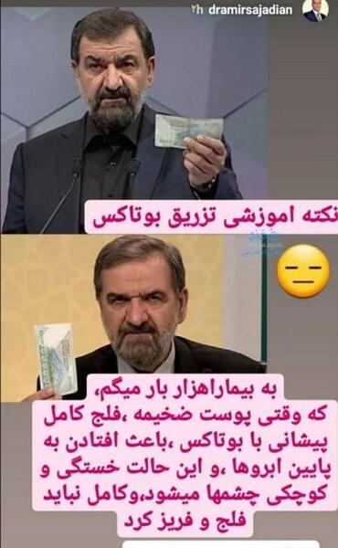 عکس قبل بعد بوتاکس محسن رضایی