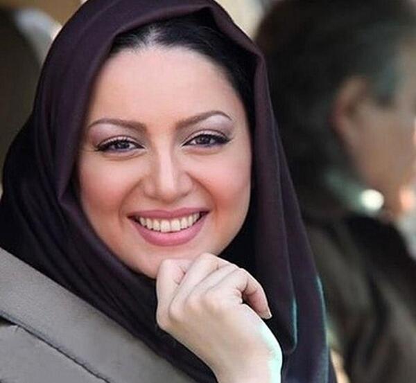 عکس شیلا خداداد قبل و بعد عمل بینی
