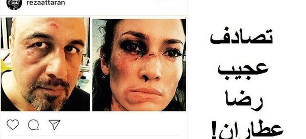 عکس تصادف رضا عطاران