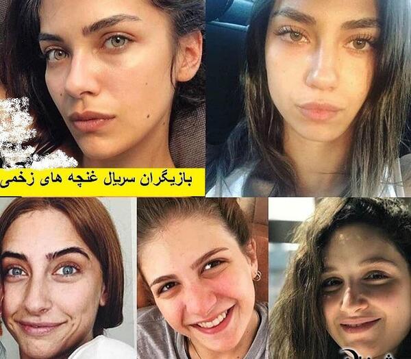عکس بازیگر غنچه های زخمی