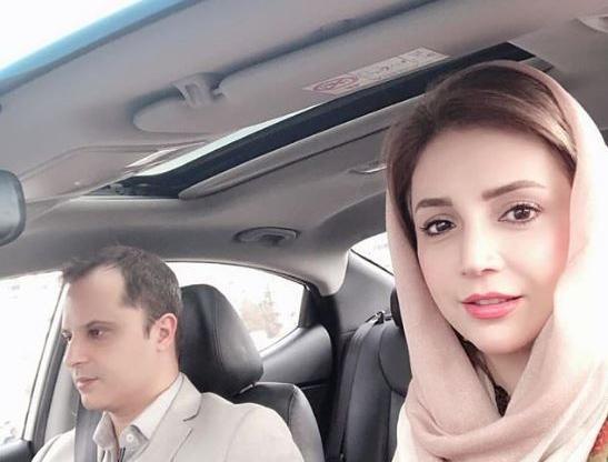عکس شبنم قلی خانی قبل از عمل زیبایی