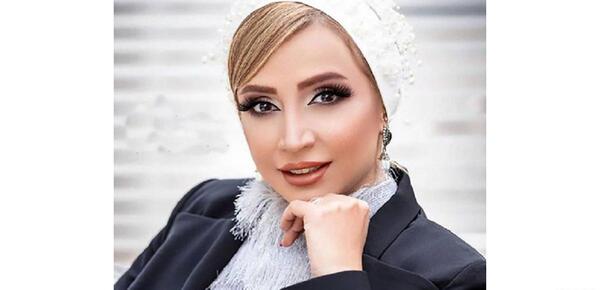 عکس شبنم قلی خانی قبل از عمل زیبایی