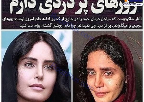 عکس کودکی الناز شاکردوست