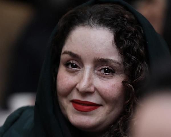 عکس ژاله صامتی قبل از عمل بینی