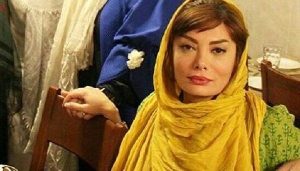 عکس ژاله صامتی قبل از عمل بینی