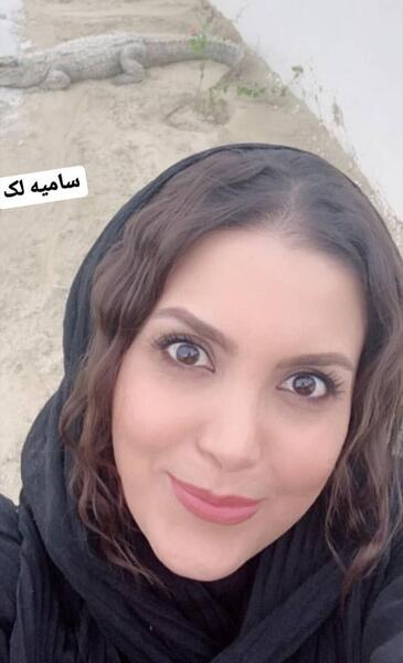 عکس سامیه لک قبل از عمل بینی