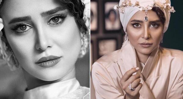 عکس قبل از عمل الناز حبیبی
