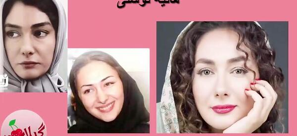 عکس دیبا زاهدی قبل از عمل بینی